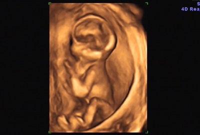 b超中的胎宝宝,千姿百态好可爱__网易亲子