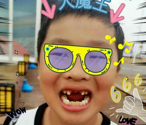 换牙了,门牙漏风