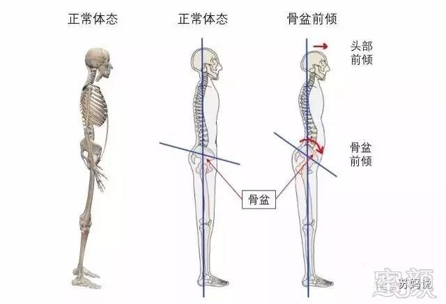 虽然腰臀比,bmi 值和体重都在正常范围,但小腹仍旧前凸.