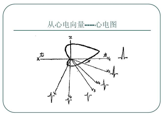 临床心电向量图-沈絮华ppt