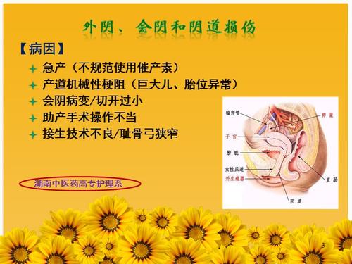 软产道损伤-推荐课件