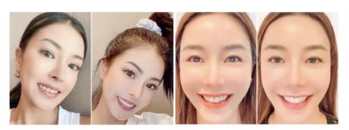 优梨美牙怎么加盟的,完美大使美牙靠谱吗