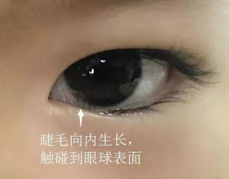倒睫不正经的眼睫毛