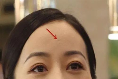 什么叫天庭富贵坑 天庭富贵坑不是每个人都有