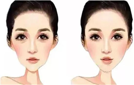 因此导致很多年轻人不喜欢颧骨高的长相,认为高颧骨代表着丑,刻薄.