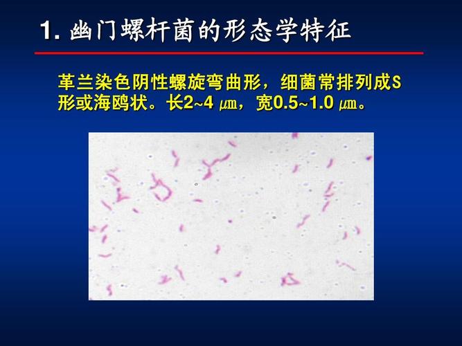 幽门螺杆菌的形态学特征 革兰染色阴性螺旋弯曲形,细菌常排列成 s 形