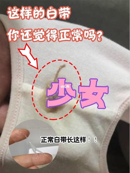白带又腥又臭你还觉得正常吗?