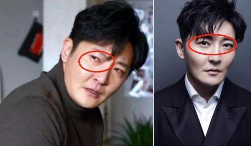 郭京飞做割眼袋手术,"笑星"形象秒变气质男神,网友:像