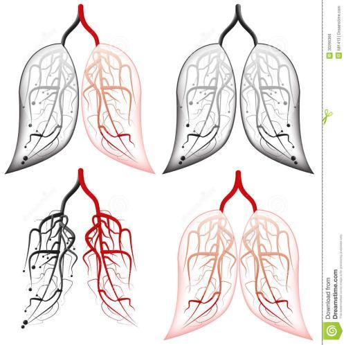 肺共几画第八画是什么什么是肺气肿肺减容手术人体肺简笔画