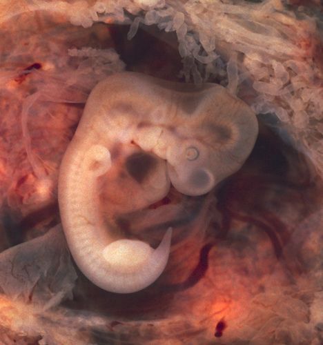 七周大的人类胚胎(human embryo at 7 weeks)