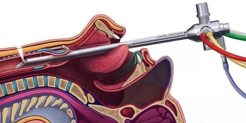 媒体聚焦江西日报小内镜解决大难题呼吸内镜介入科发展侧记