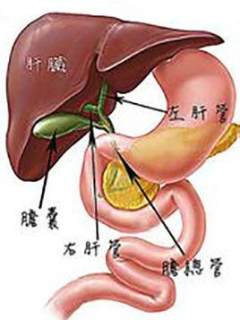 胆管癌是指原发于左右肝管汇合部至胆总管下端的肝外胆管恶性肿瘤原