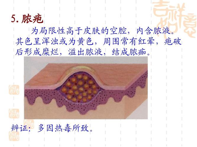 辨证:多因热毒所致.