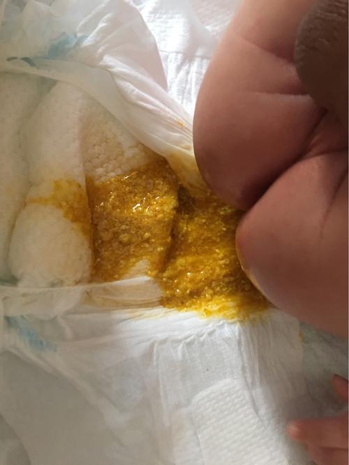 哭闹,吃点就肚子打挺,每次只吃到40.以前一顿最少吃100.