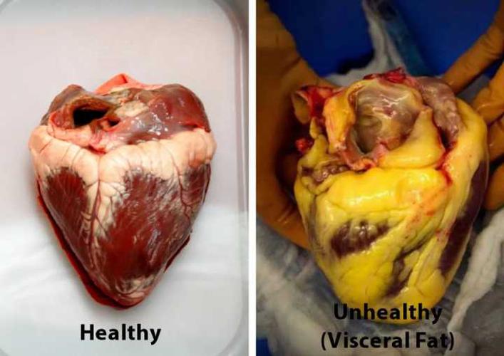 【轻益生活】真正的健康杀手,内脏脂肪过多怎么减?