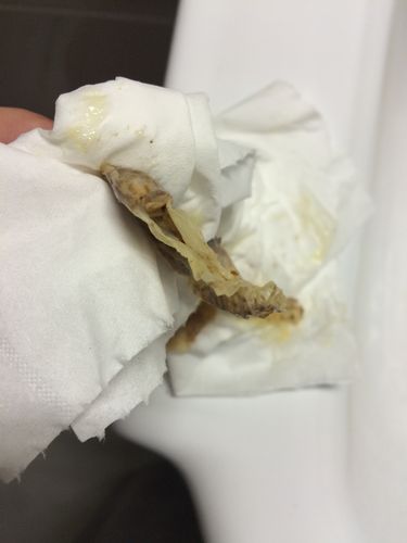 5 分钟前颜洛离 分类:电脑/网络来自:手机知道 妇产科医疗   &