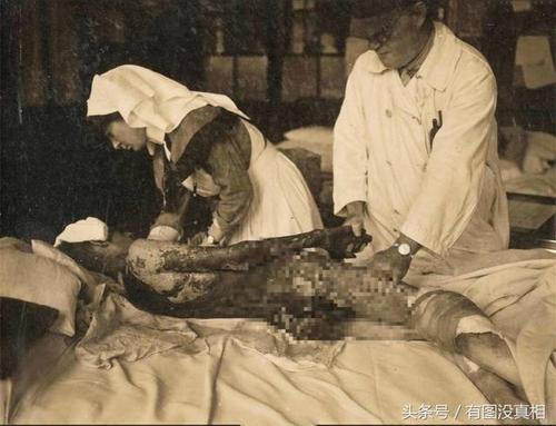 老照片:一战时期的毒气战,活下去真的需要勇气