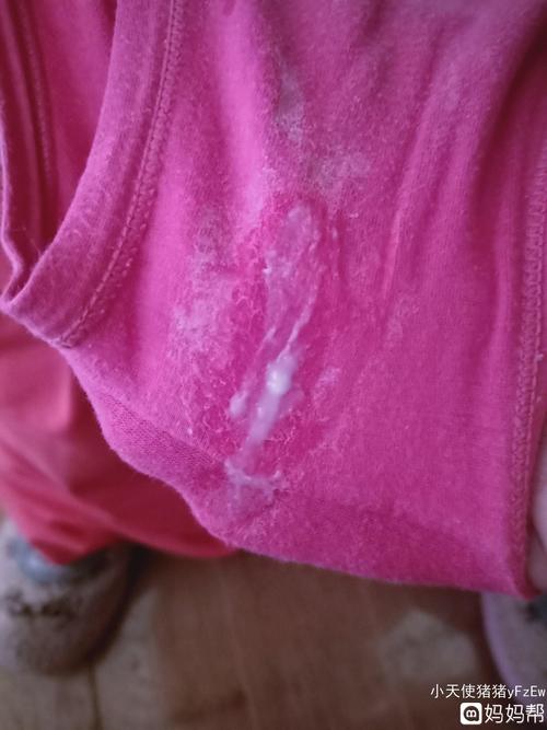 怎么会这么多白带,其他的宝妈会不会也像我