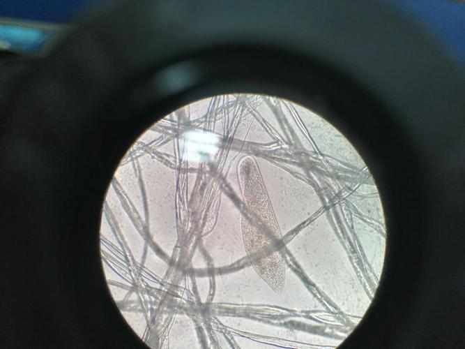 显微镜下观察到的草履虫.