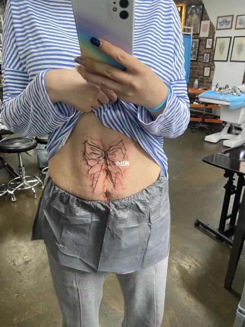 产后双胎妈妈的肚皮 妊娠纹 纹身遮盖!_纹身_妊娠纹