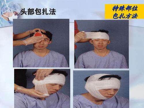 创伤出血急救与包扎最新修ppt