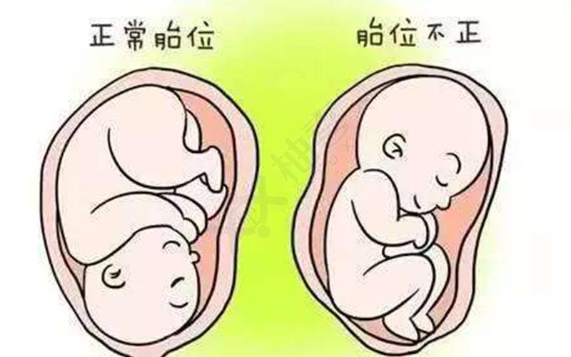 roa和loa两种胎位区别对比哪个更好其实并没差