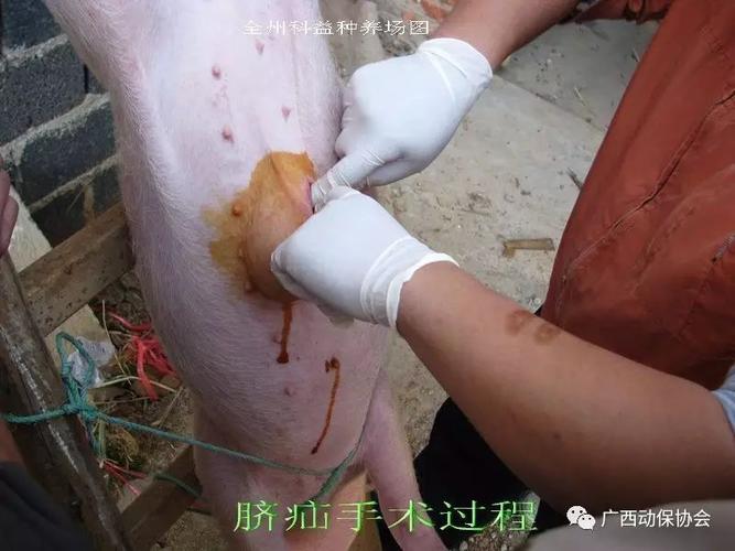 【诊疗】脐疝的治疗(附手术图解)
