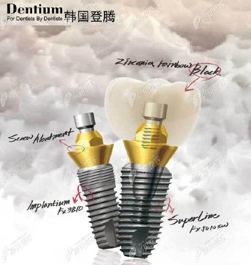韩国种植牙品牌中为什么奥齿泰比登腾贵?区别在哪