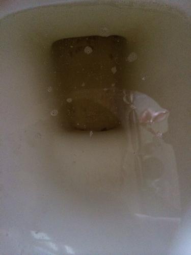 尿液里总有一些小泡沫