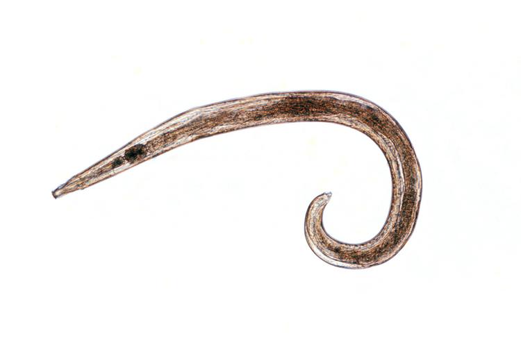 学名蠕形住肠线虫,是蛔目尖尾科住肠线虫属下的动物,又叫蛲虫,屁股虫