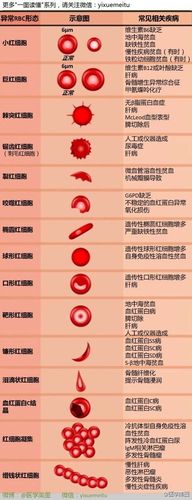 红细胞异常及相关疾病