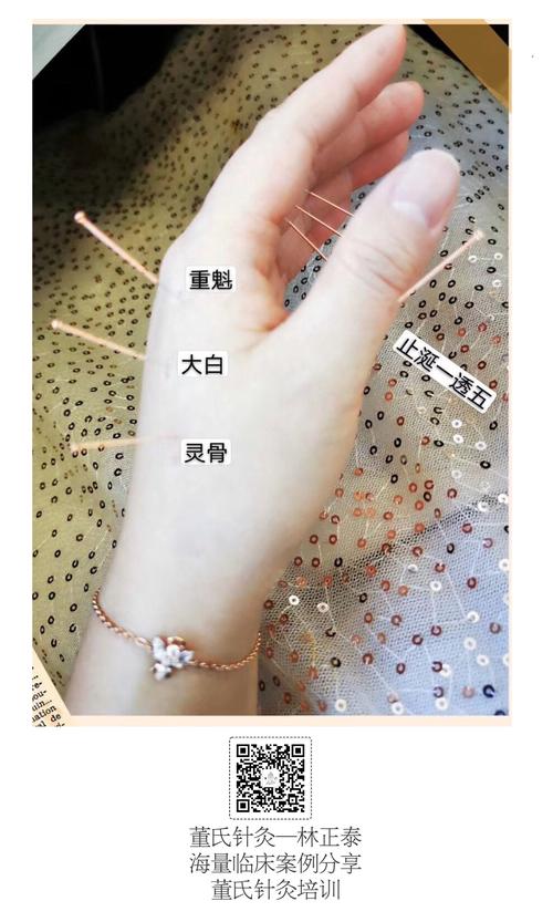 二二部【灵骨,大白,重魁】