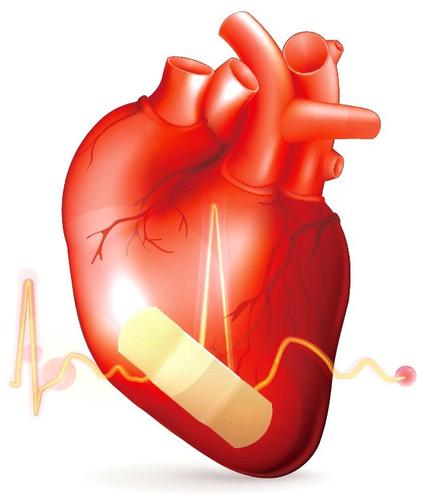 1,心源性水肿:心源性水肿是由于心脏功能障碍引发的机体水肿,各种