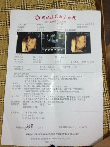 确认女宝四维图