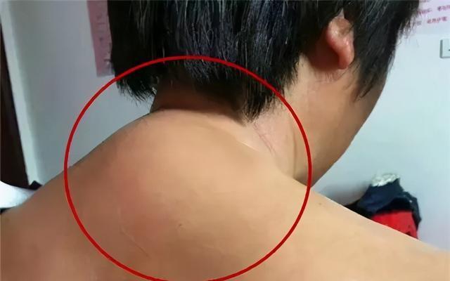 佟丽娅官宣美肩纤臂美若仙坚持2步抹平富贵包重获直角肩