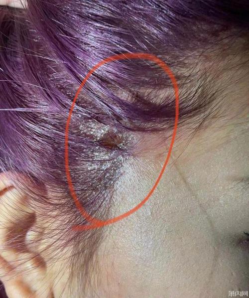 她在萧内网 app 发帖说,自己去萧山某理发店想染个灰紫色头发,结果漂