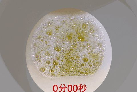 泡沫尿,就是蛋白尿,就是肾功不全吗?医生辟谣,讲清楚诸多因素