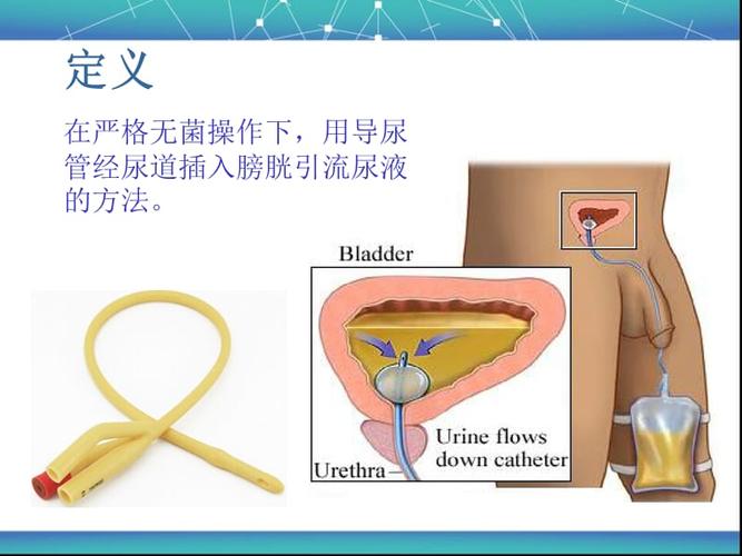 留置尿管的健康教育.ppt