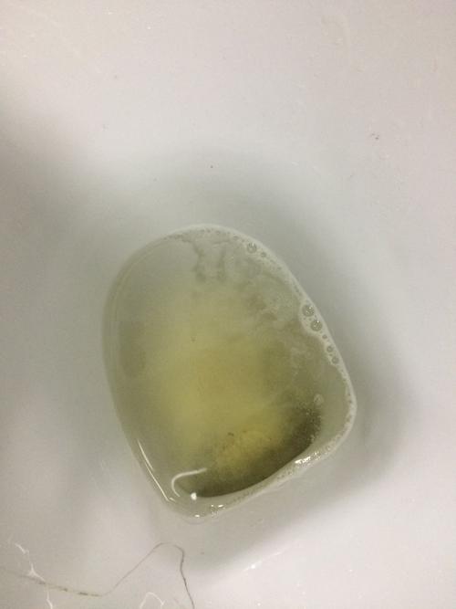 尿液的动力和泡沫