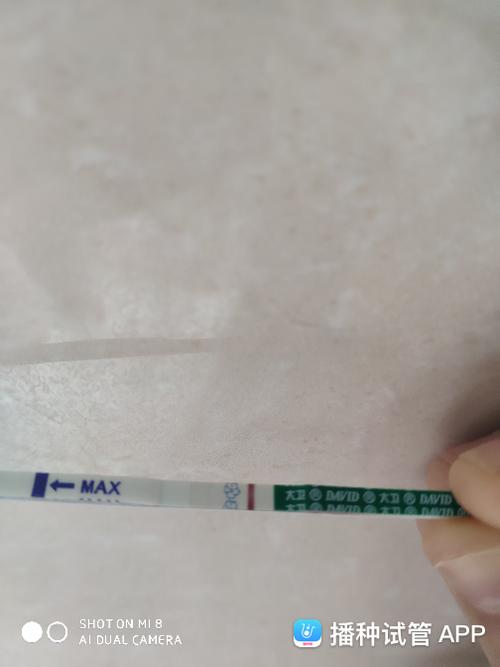 我跟你一样的.今天也第八天.刚刚又拍了一张照片,是不是意念灰呢?