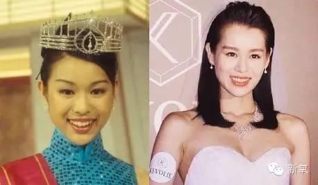 她曾是最丑港姐,如今做了baby同款整形而逆袭变美