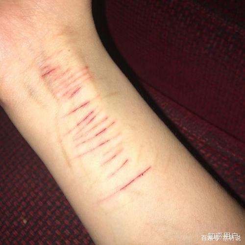 许多学生用刀自残