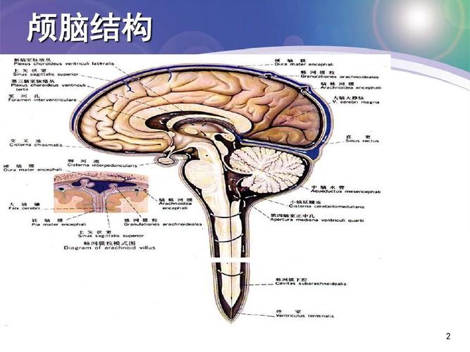蛛网膜下腔出血的护理要点医学ppt课件