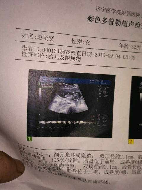 3个亮点是男孩5个月b超是个男孩会不会生出来