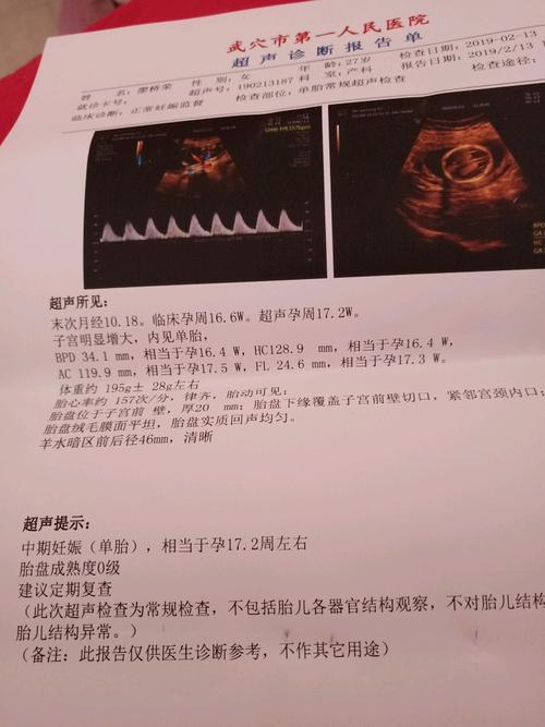 完全性前置胎盘