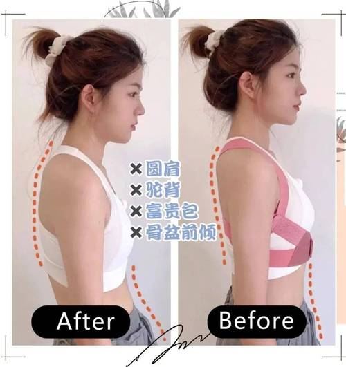 女生驼背 圆肩有多丑?穿衣显土都是因为它!99%已中招!