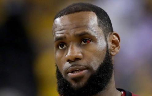 (詹姆斯的眼睛充血比上场更严重了)