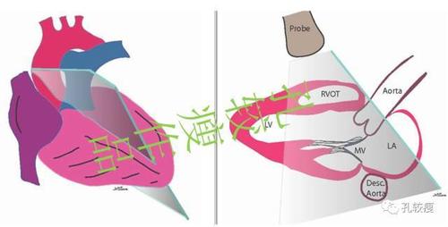 一文读懂心脏超声基本切面