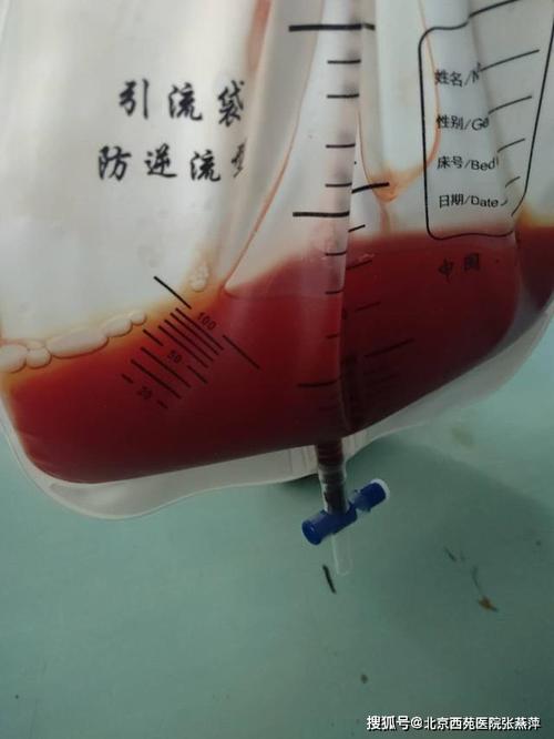 同样都是胸腔积液,为什么它们的颜色不一样?_手机搜狐