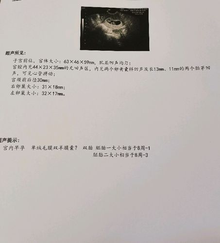 孕7周 5天呼和浩特市2020年7月 我的宝宝是同卵双胞胎,之前看别人说